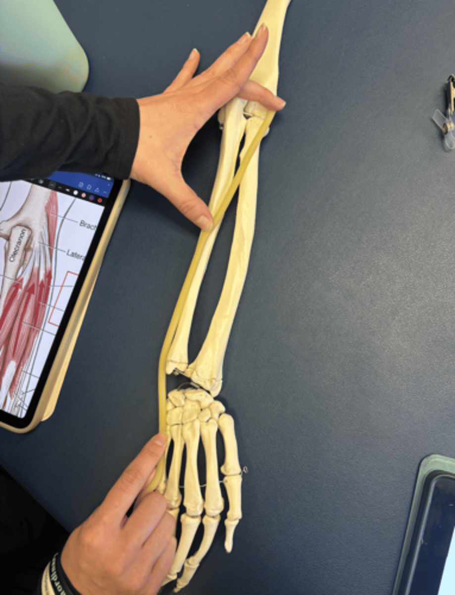 <p>What is this muscle?</p>