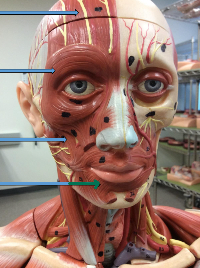 <p>Identify this muscle?</p>