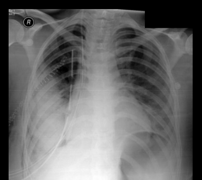 <p>what type of tube is this?</p>