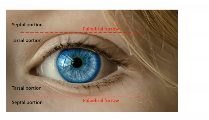 <p>toughest part - protective area of eyelid </p><p>made of connective tissue </p><p>protects from foreign bodies </p><p>covers the globe</p><p></p>