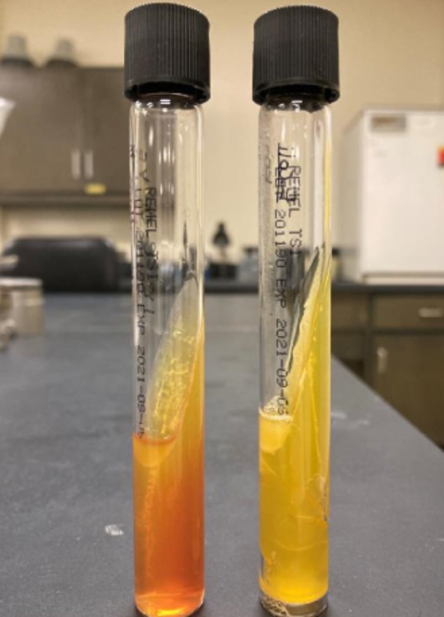 <p>Oxidase-negative</p><p>"sick TSI"</p><p>Penicillin susceptibility</p>