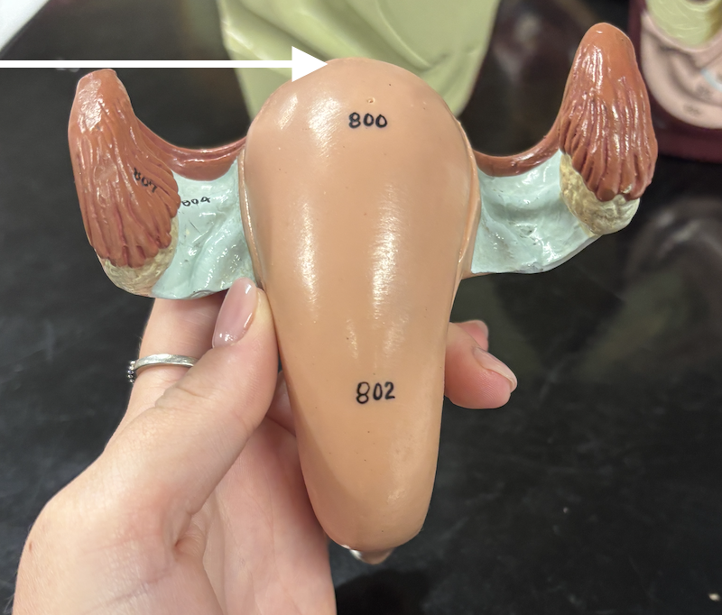 <p>what structure is the arrow pointing to? </p>