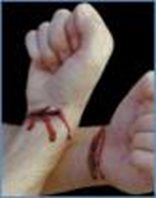 <p>what type of personality disorder can be seen in the picture?</p>