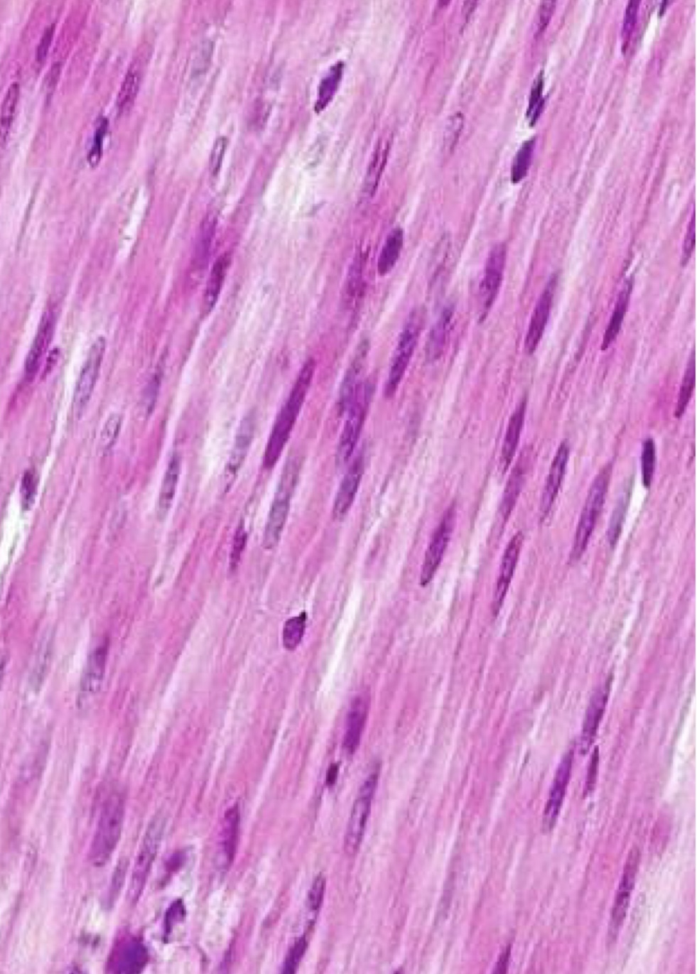 <p>What type of muscle</p>