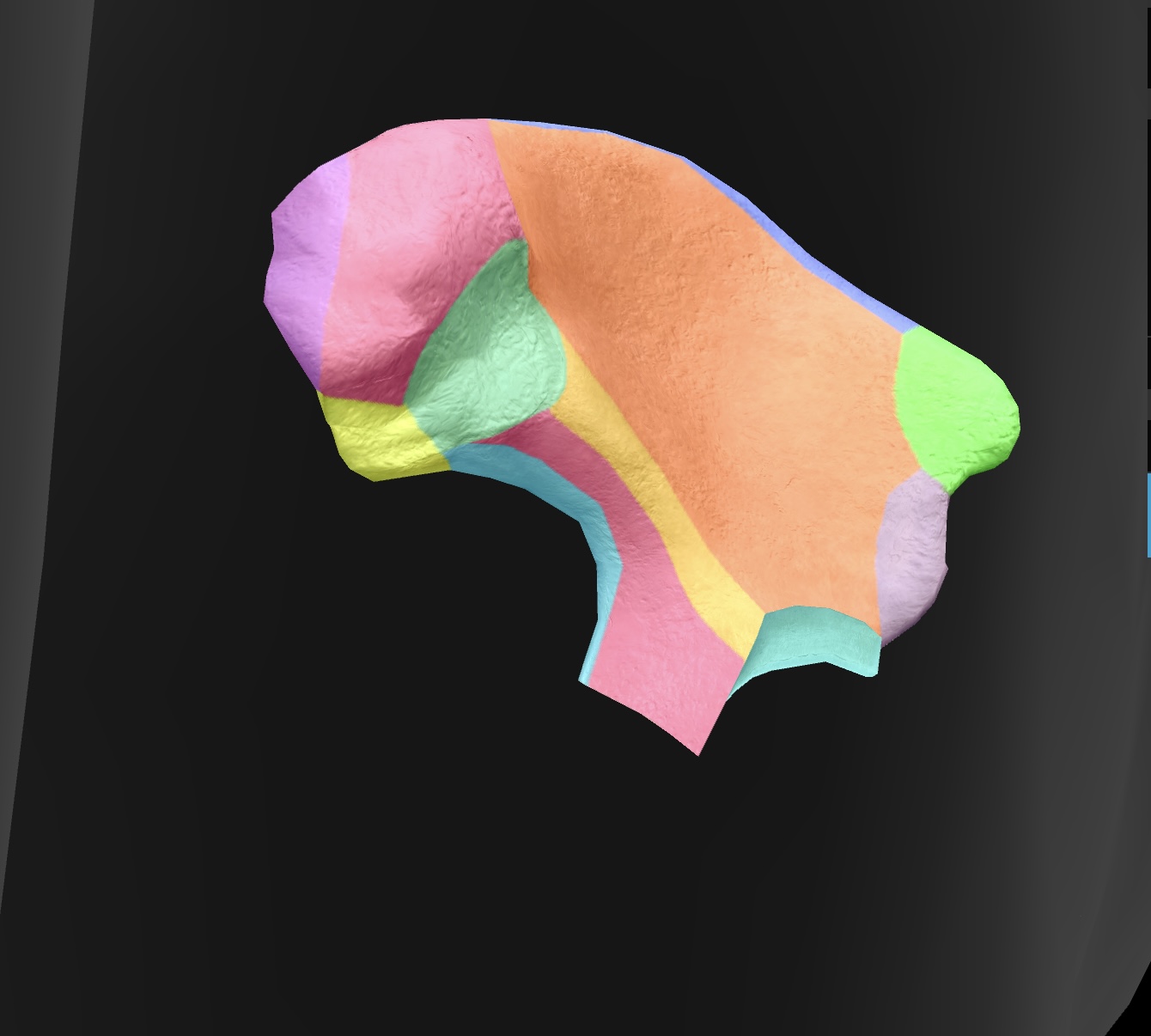 <p>A large indentation on the posterior border of the ilium — becomes the greater sciatic foramen as the sacrospinal ligament closes the notch, piriform passes through it. superior gluteal vessels & nerve pass above the piriformis in the foramen, & the inferior gluteal vessels & sciatic nerves pass inferior to the piriformis </p>