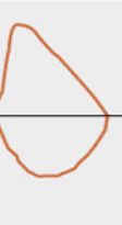 <p>what is this flow volume loop showing </p>