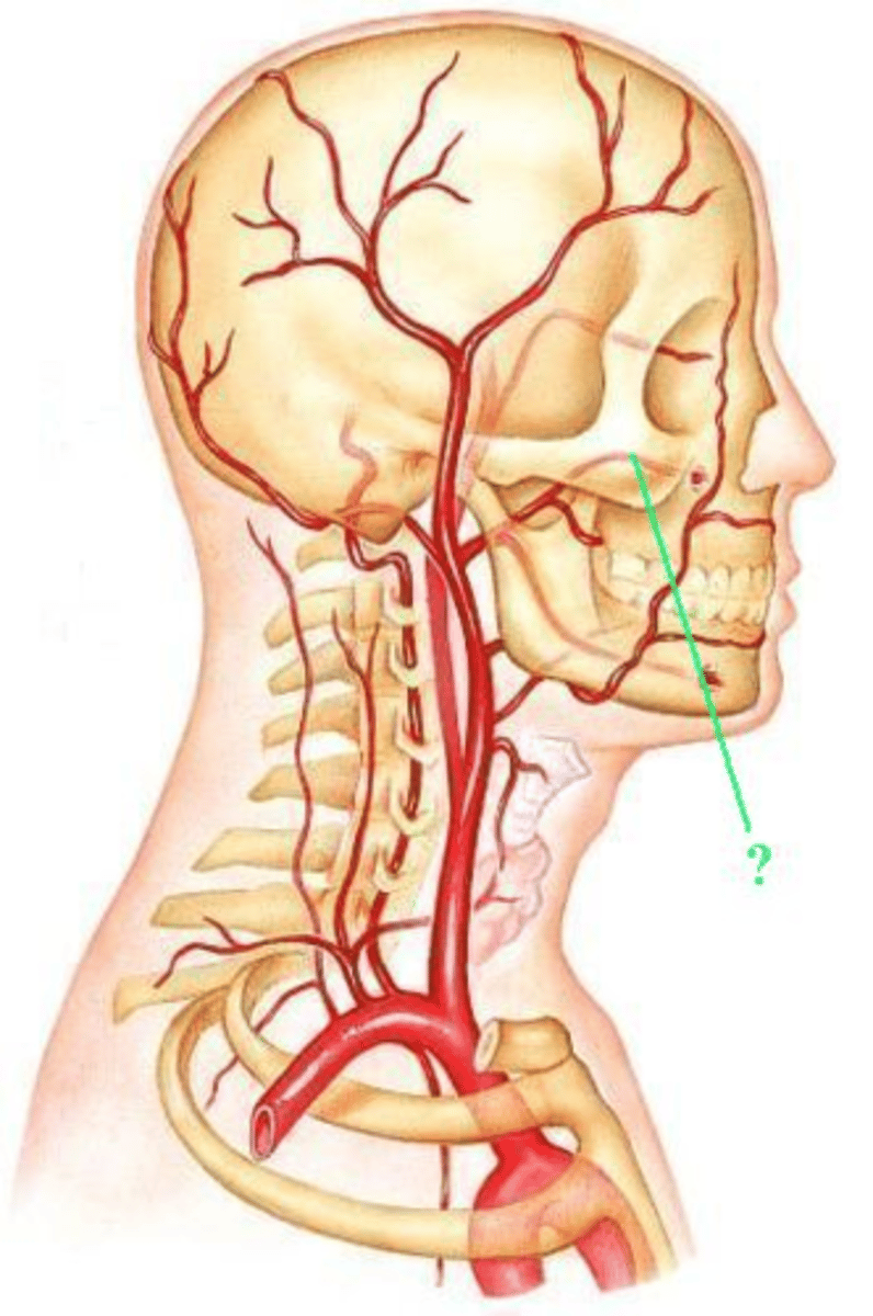 <p>Identify the indicated blood vessel.</p>