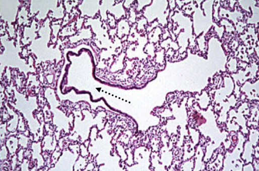 Identifying features:

•Ciliated simple cuboidal

•Goblet cells

•No cartilage
