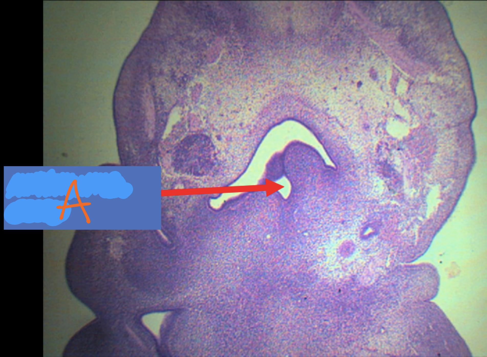 <p>Identify the structure</p>