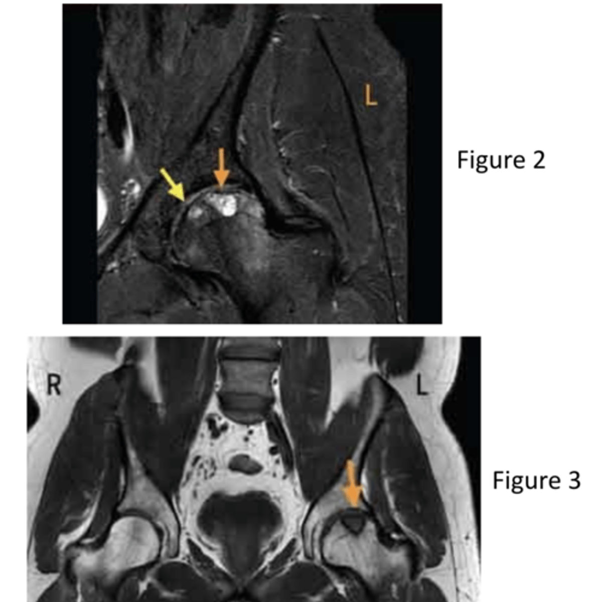 <p>coronal and coronal</p><p>3 multiple choice options</p>