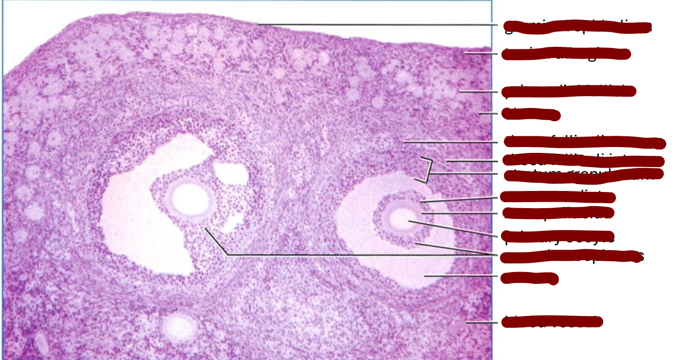 <p>section through an area of a mature cat ovary </p>