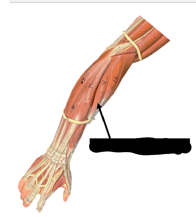 <p>Origin: lateral epicondyle of humerus</p><p>Function: extends and abducts wrist</p>