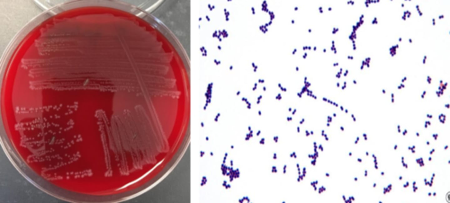 <p>beta hemolytic (small zone)</p><p>grey pigment</p><p>smallish colony</p><p>cocci in pairs</p>