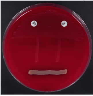 <ul><li><p>gamma-hemolysis (red)</p></li><li><p>non-lancefield</p></li><li><p>negative for all tests</p></li></ul><p></p>