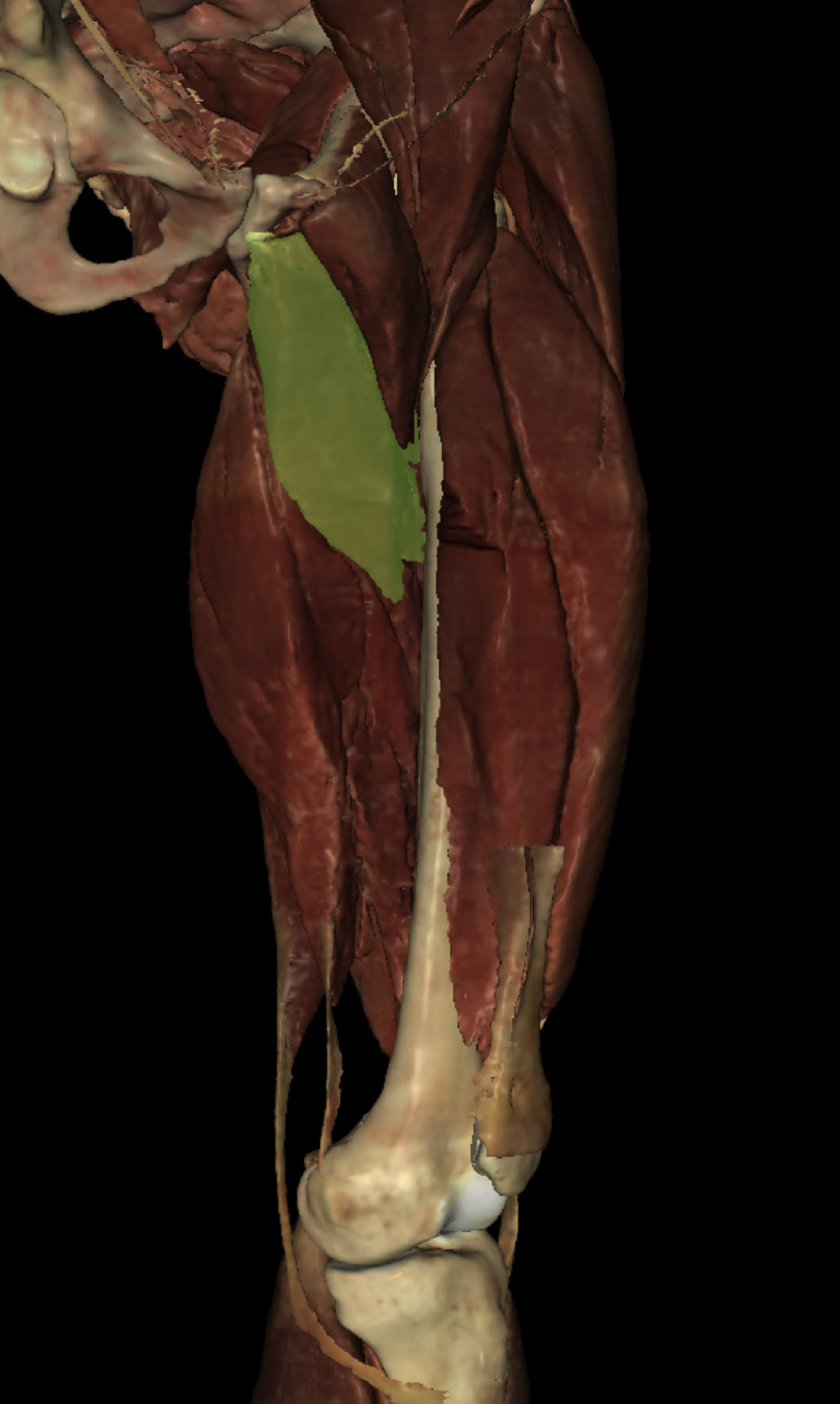 <p>Identify the Structure</p>