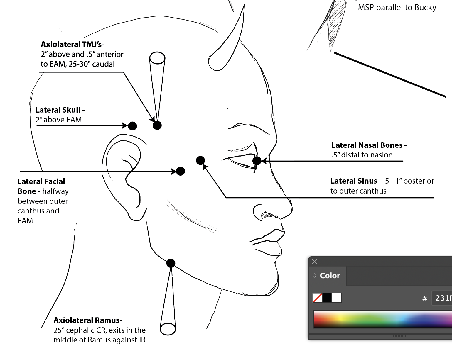 <p></p><p>2” above external auditory meatus</p>