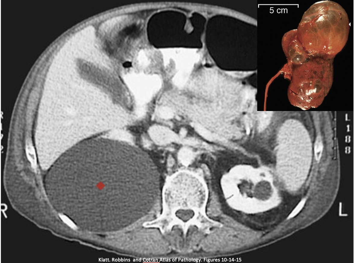 <p>What pathology do these images show?</p>