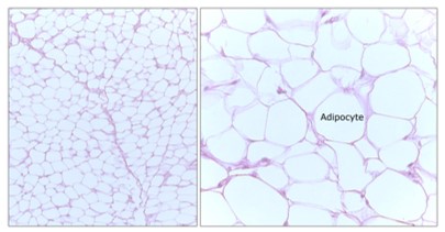 <p>What tissue is shown&nbsp;</p>