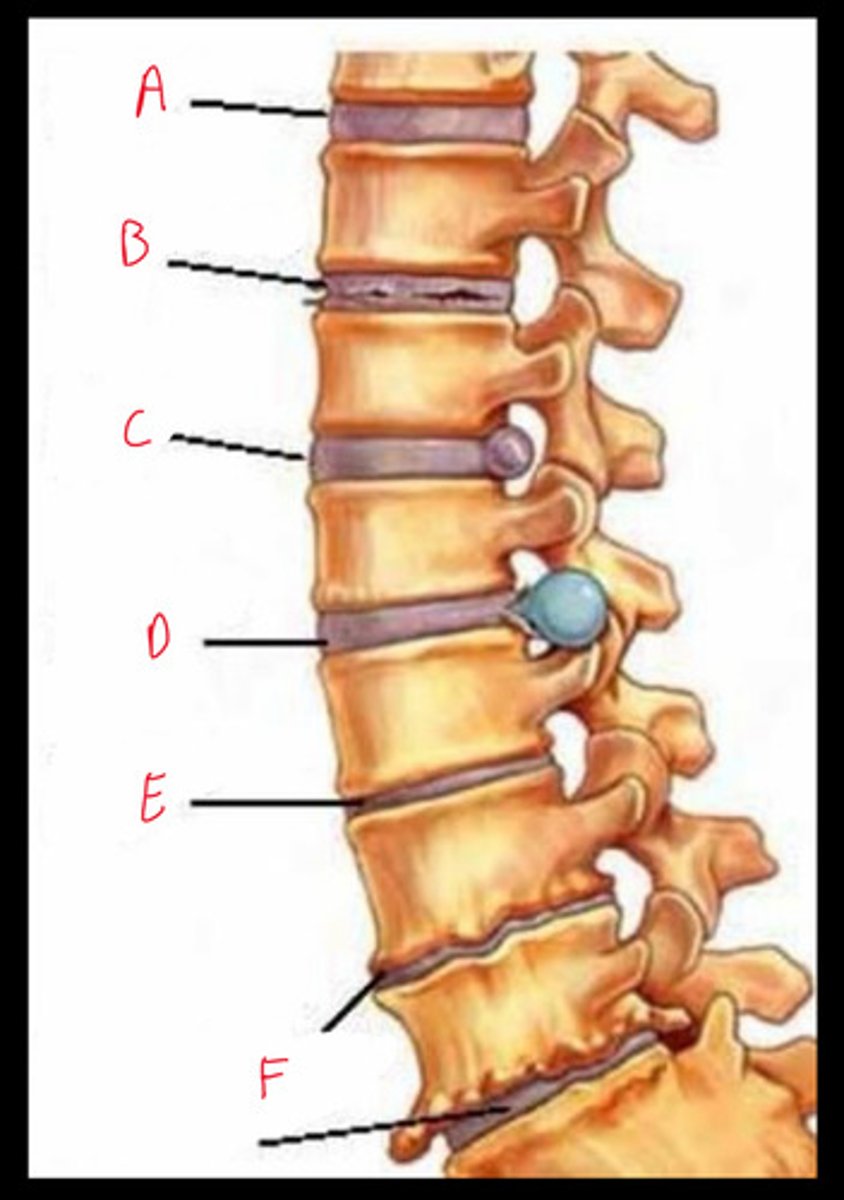 <p>C5/6 or C6/7</p>