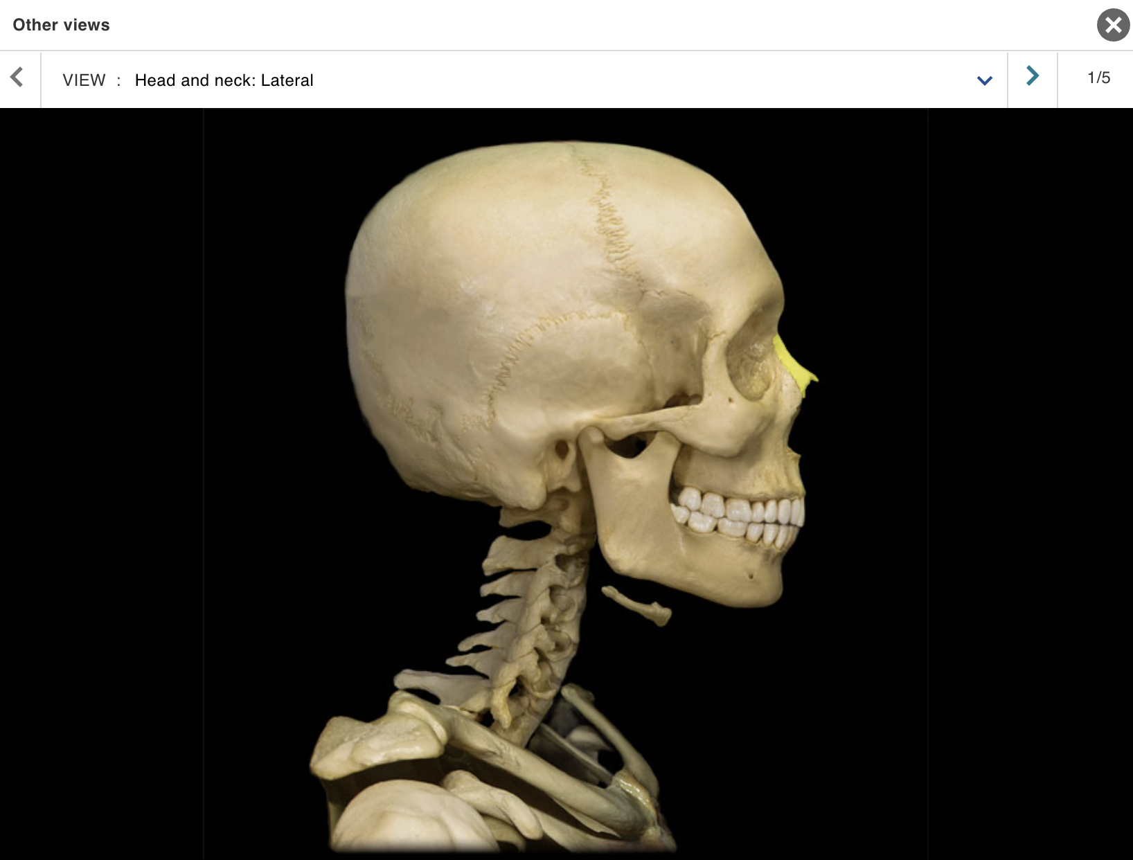 <p>Location:</p><p class="p1">• Skull (anterior)</p><p class="p1">Description:</p><ul><li><p>﻿﻿Small, paired bone</p></li><li><p>﻿﻿Articulates at midline with nasal bone from opposite side</p></li></ul><p class="p1">Also known as:</p><p class="p1">• "Bridge of nose"</p><p class="p1">Comment:</p><p class="p1">• Forms bony part of nose</p>