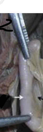 <p>Identify this structure (white arrow)</p>
