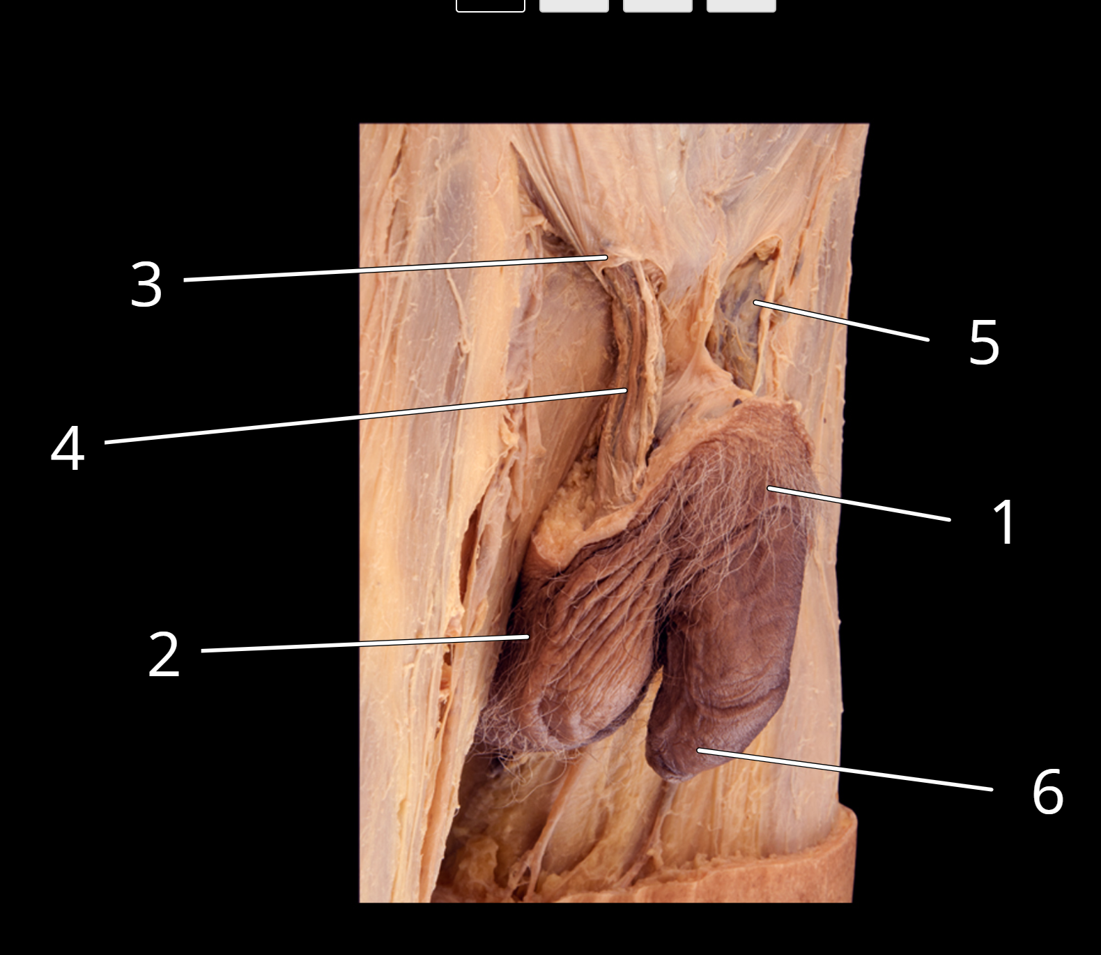 <p>Penis and testis, lateral view </p>