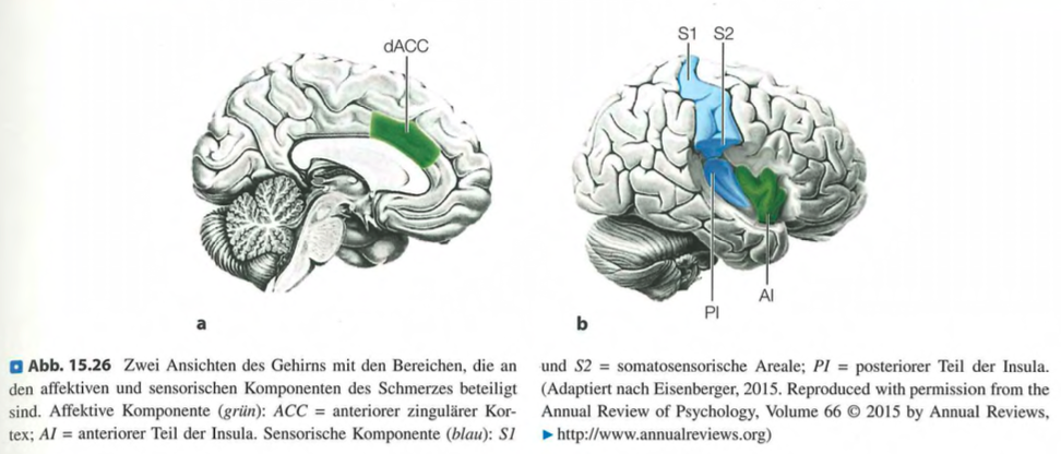 <p class=""><strong>Kurzfassung:</strong><br><strong>Schmerz</strong> hat <strong>sensorische</strong> (z. B. Stechen, Brennen) und <strong>emotionale</strong> (Unwohlsein, Leiden) Komponenten, die in <strong>verschiedenen Gehirnarealen</strong> verarbeitet werden.</p><div data-type="horizontalRule"><hr></div><p class=""><strong>Langfassung:</strong></p><ul><li><p class=""><strong>Multimodaler Charakter:</strong></p><ul><li><p class="">Schmerz ist <strong>mehr als ein physisches Signal</strong> – er umfasst auch <strong>emotionale Verarbeitung</strong>.</p></li></ul></li></ul><p class=""></p><ul><li><p class=""><strong>Beteiligte Strukturen:</strong></p><ul><li><p class=""><strong>Subkortikal:</strong> Hypothalamus, Amygdala, Thalamus.</p></li><li><p class=""><strong>Kortikal:</strong></p><ul><li><p class=""><strong>S1 (somatosensorischer Kortex):</strong> sensorische Qualität des Schmerzes.</p></li><li><p class=""><strong>Anteriorer zingulärer Kortex (ACC):</strong> emotionale Bewertung des Schmerzes.</p></li><li><p class=""><strong>Präfrontaler Kortex & Insula:</strong> emotionale und kognitive Bewertung, Integration.</p></li></ul></li></ul></li></ul><p class=""></p><ul><li><p class=""><strong>Trennung der Komponenten:</strong></p><ul><li><p class=""><strong>Sensorisch:</strong> Stechen, Pochen → Aktivität in <strong>S1</strong>.</p></li><li><p class=""><strong>Emotional:</strong> Leiden, Unbehagen → Aktivität im <strong>ACC</strong>.</p></li></ul></li></ul><p class=""></p><ul><li><p class=""><strong>Beleg durch Hypnose-Studien:</strong></p><ul><li><p class=""><strong>Hypnotische Suggestion</strong>, die gezielt nur die <strong>Intensität</strong> oder das <strong>Unwohlsein</strong> beeinflusste, veränderte je nach Fokus <strong>unterschiedliche Hirnareale</strong>.</p></li></ul></li></ul><p class=""></p><ul><li><p class=""><strong>Fazit:</strong><br>Schmerz ist ein <strong>komplexes Phänomen</strong>, das <strong>nicht nur im Körper</strong>, sondern <strong>vielschichtig im Gehirn verarbeitet</strong> wird.</p></li></ul><p></p>