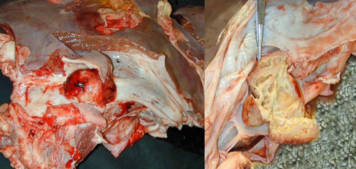 <p>Lever fra kvæg m. v. cava caudalis, hvad er den patoanatomiske diagnose?</p>
