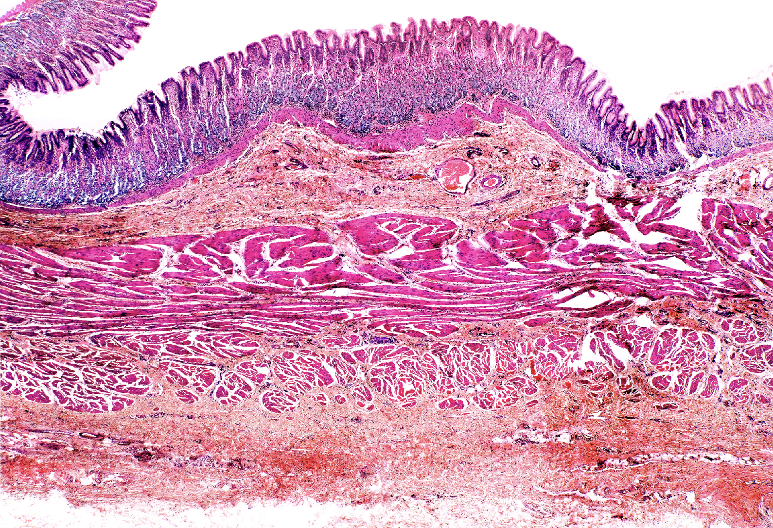 <p>List the layers of the stomach </p>