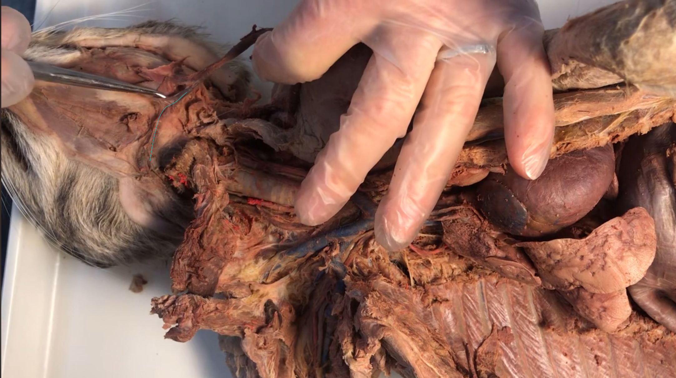 <p>What vein is this</p>