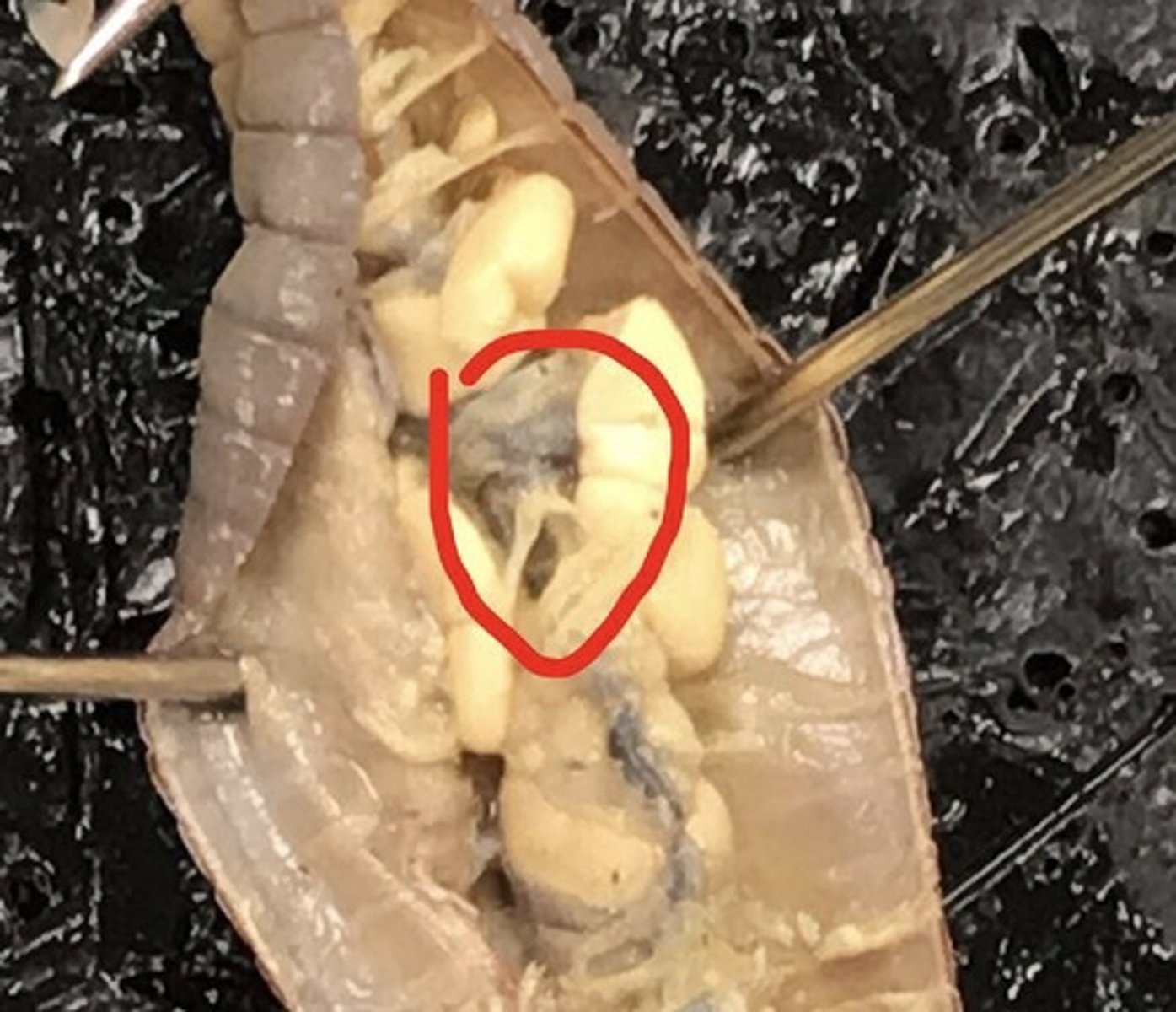 <p>What organ is this and what is its function?</p>