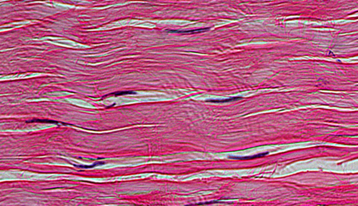 <p>ex - elastic tissue</p><p>more CT fibres, less ground substance</p>