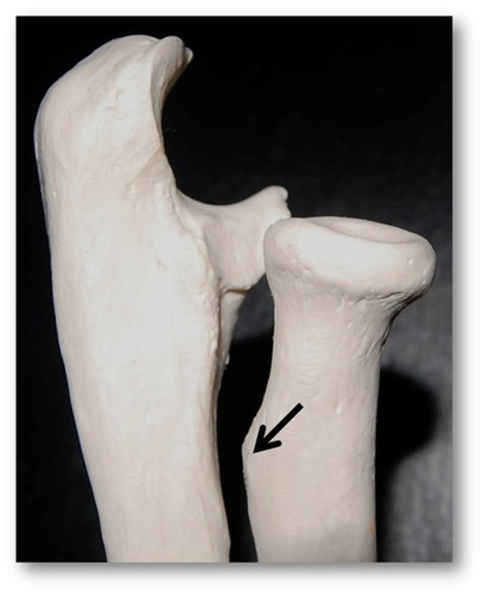 <p>Name this specific part of the radius.</p>