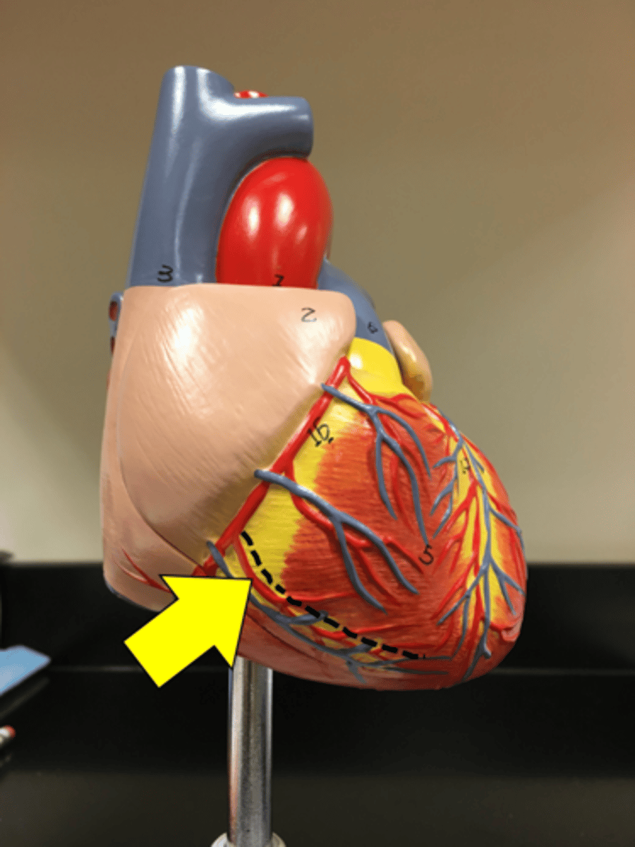 <p>Name the red vessel.</p>