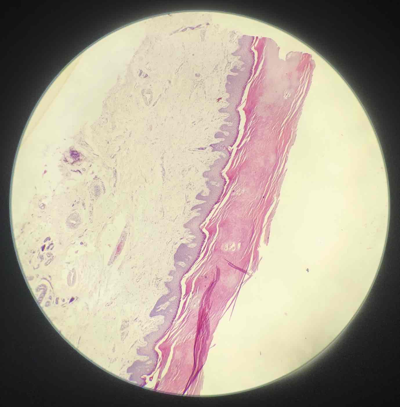 term image