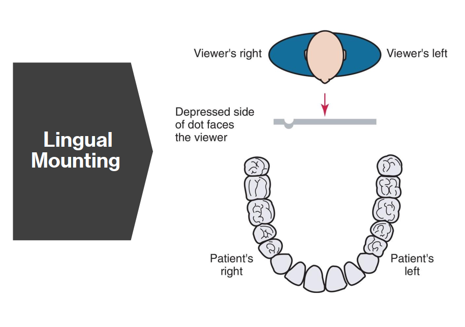 <p>Lingual mounting is a method of viewing dental radiographs as if you are<u> </u><strong><u>behind the patient</u></strong>, looking out of their mouth.</p><ul><li><p>The patient’s right side is on your right</p></li><li><p>The raised dot on the film is concave (faces away from viewer)</p></li><li><p>Less commonly used than labial mounting</p></li></ul><p><strong>Key difference to Labial Mount</strong>: Viewer’s perspective is from <strong><u>inside the patient’s mouth</u></strong><u>.</u></p>