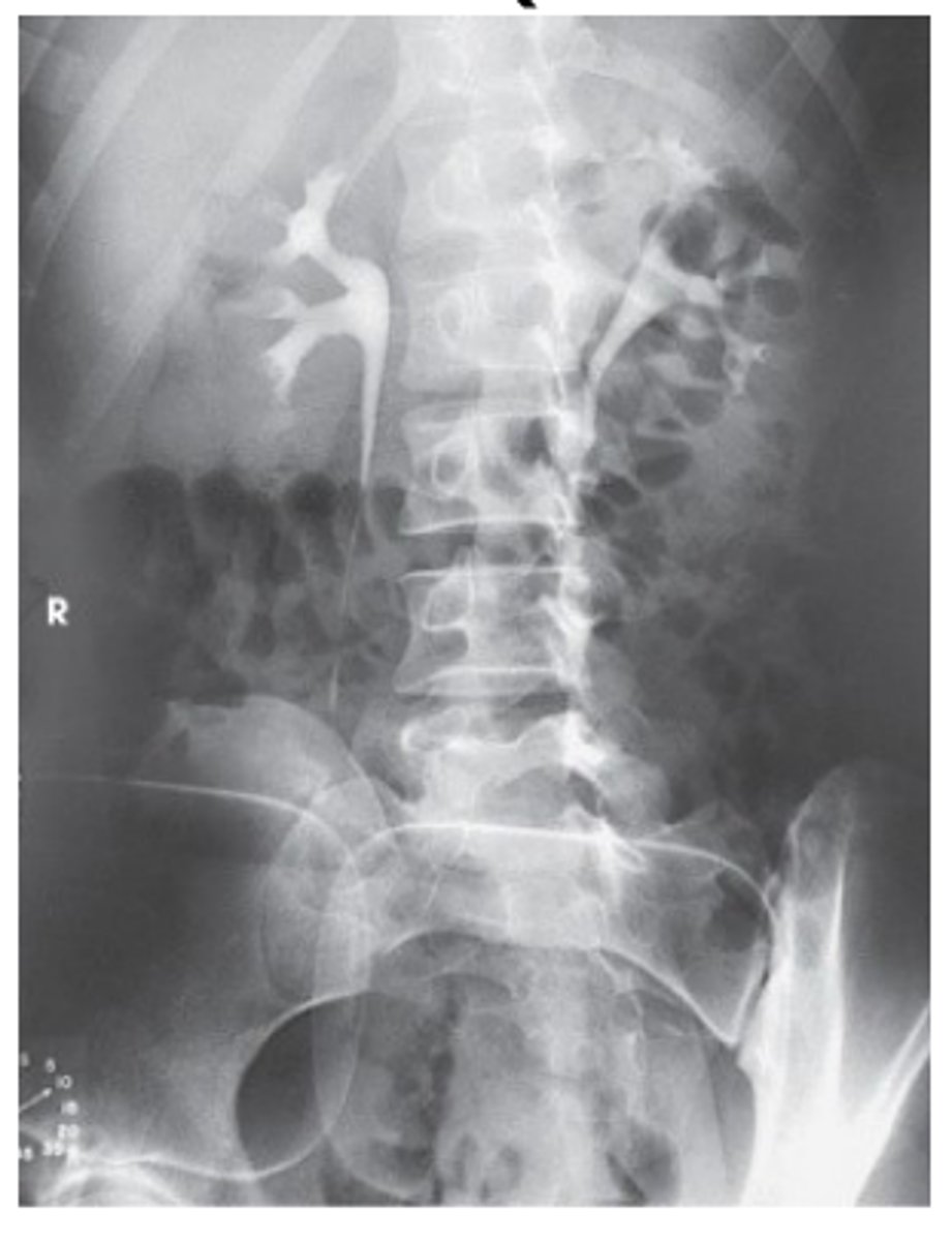 <p>30 degree oblique. Upside kidney is seen in profile, downside ureter is free of superimposition from the spine.</p><p>LPO - right kidney in profile, left ureter seen</p><p>RPO - left kidney in profile, right ureter seen</p>