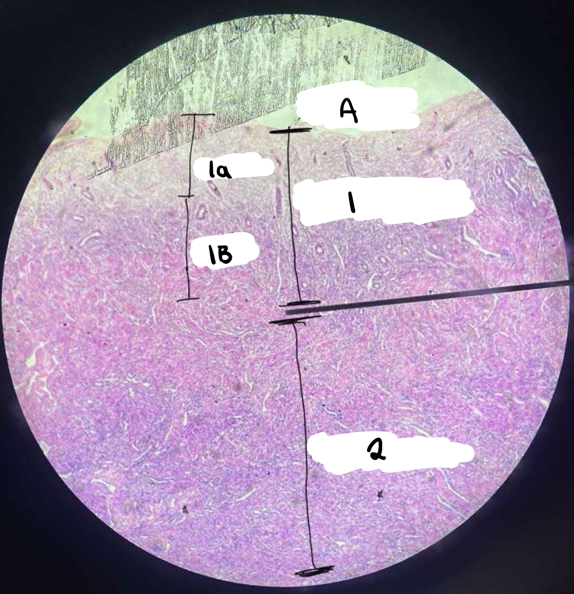 <p>1b</p>