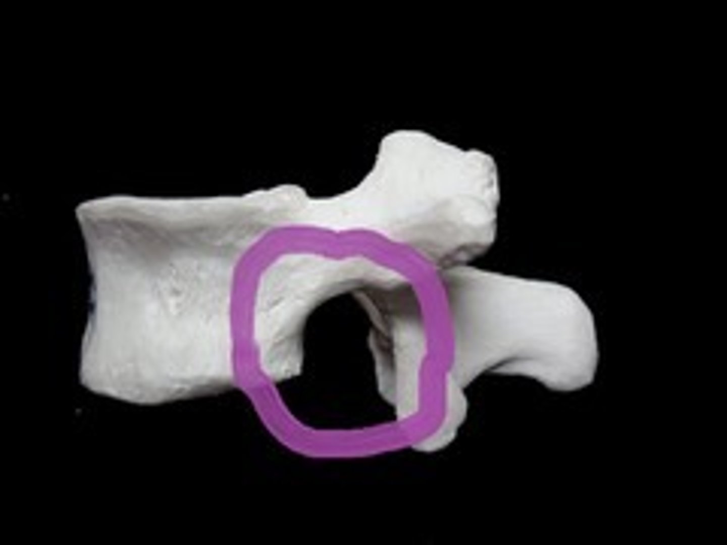<p>space for nerve passage</p>