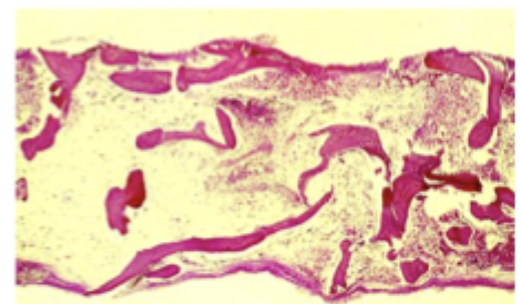 <p>Diagnostics for aplastic anemia</p>