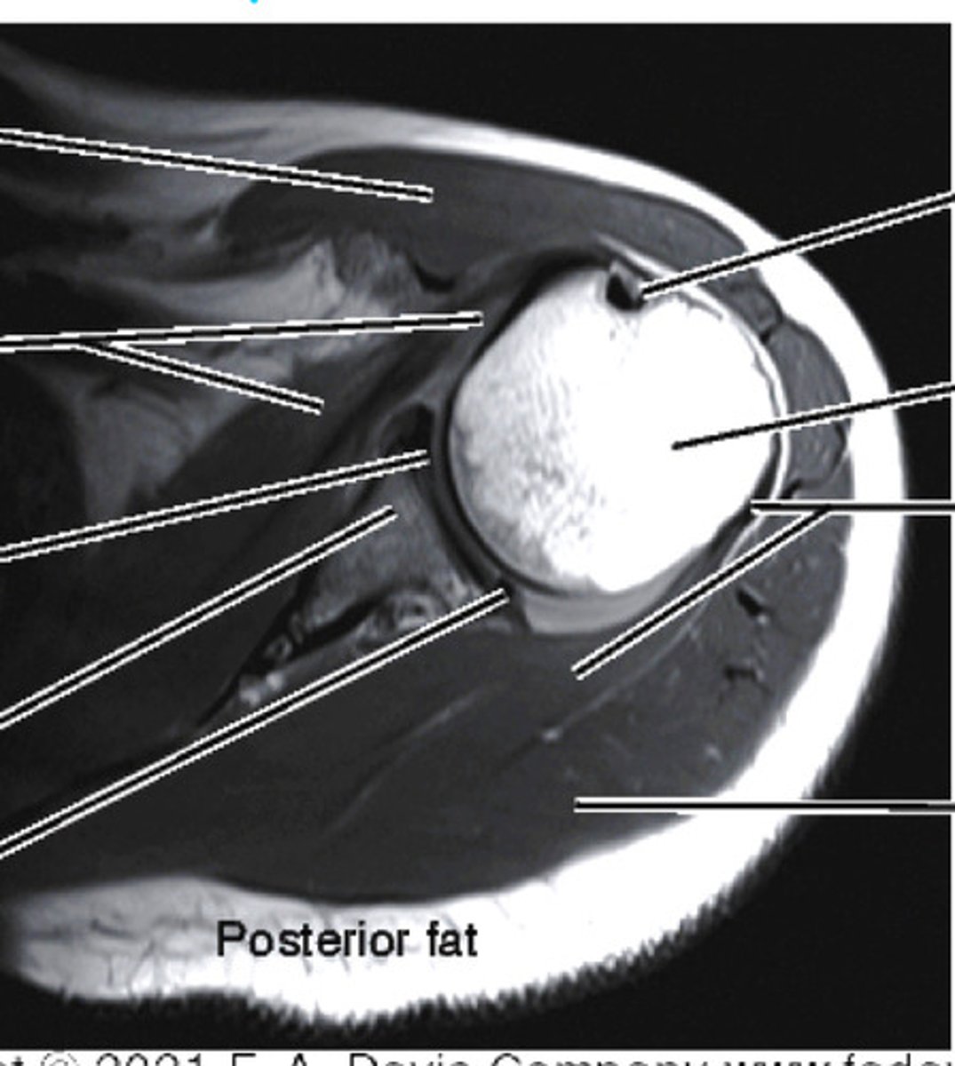 <p>see biceps tendon and labrum</p>