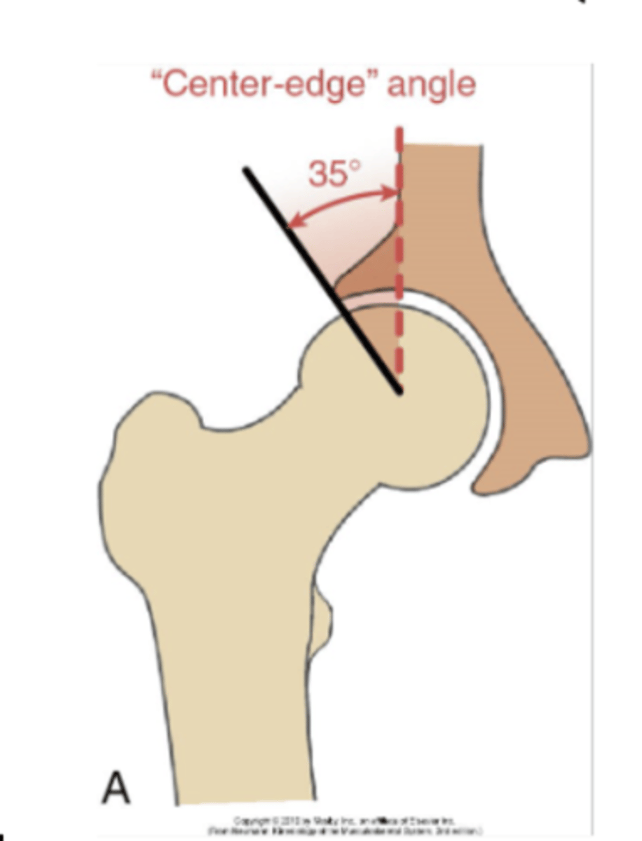 <p>Amount of acetabulum that covers the femur</p><p>Highly variable</p><p>Average 35 deg in adults</p>