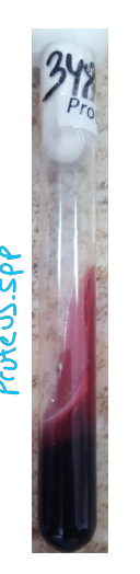 <p><strong>Kligler Agar:</strong></p><ul><li><p>completely black</p></li></ul><p></p>