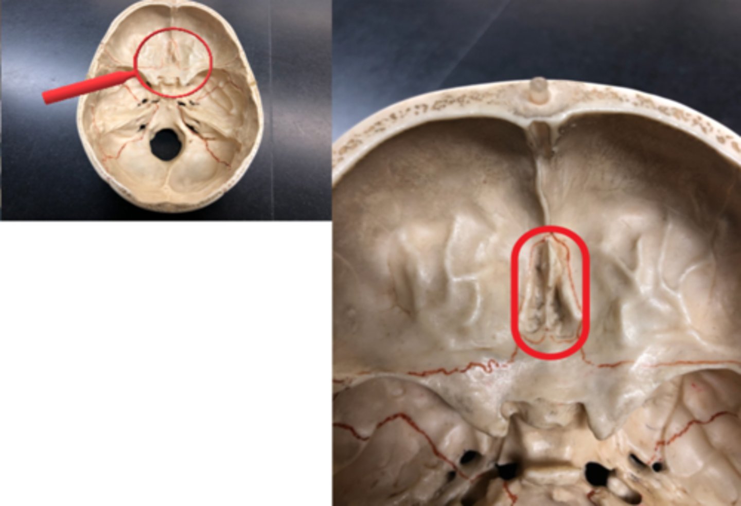 <p>unpaired bone in the skull that separates the nasal cavity from the brain.</p>