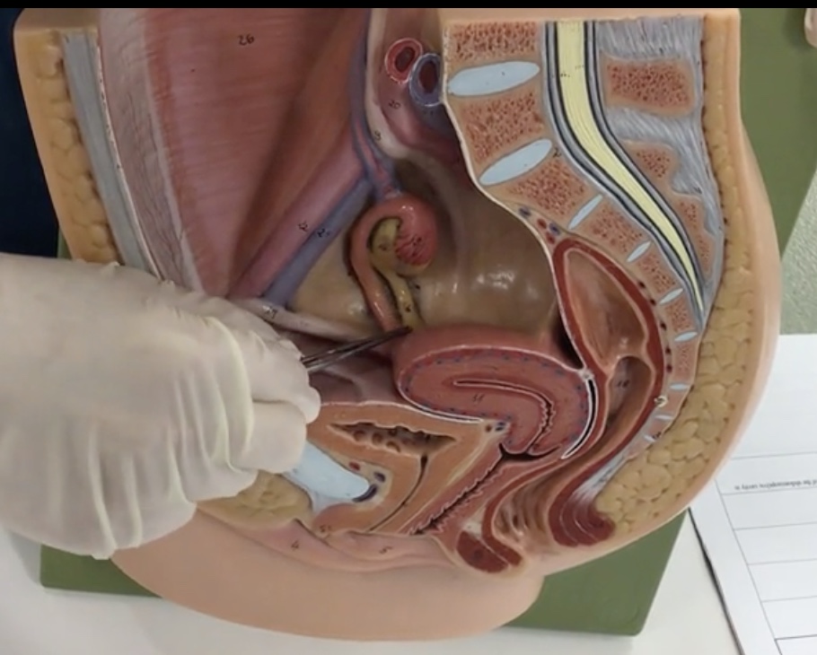 <p>Description: Fibrous cord extending from the ovaries to the uterus</p><p>Relationship: N/A</p>