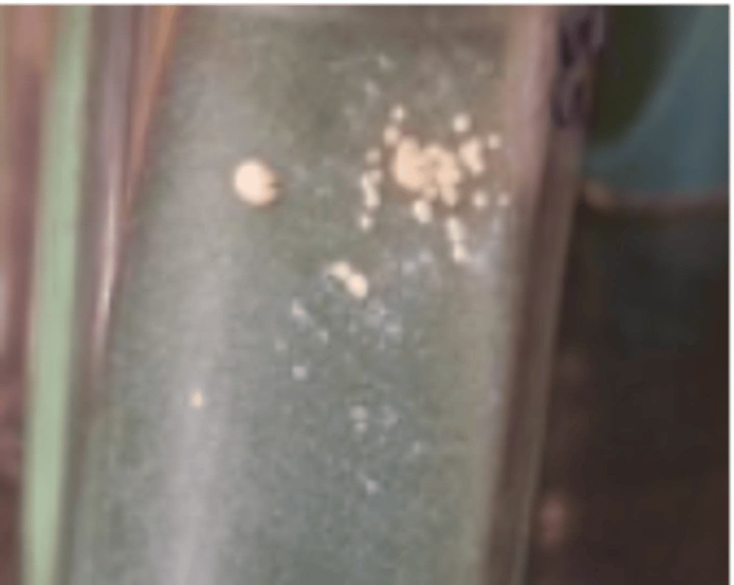 <p>what Mycobacterium spp. is indicated in this image that affects ruminants</p>