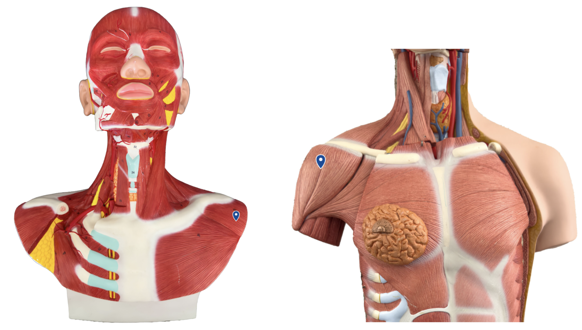 <p>What muscle is the arrow pointing to?</p>