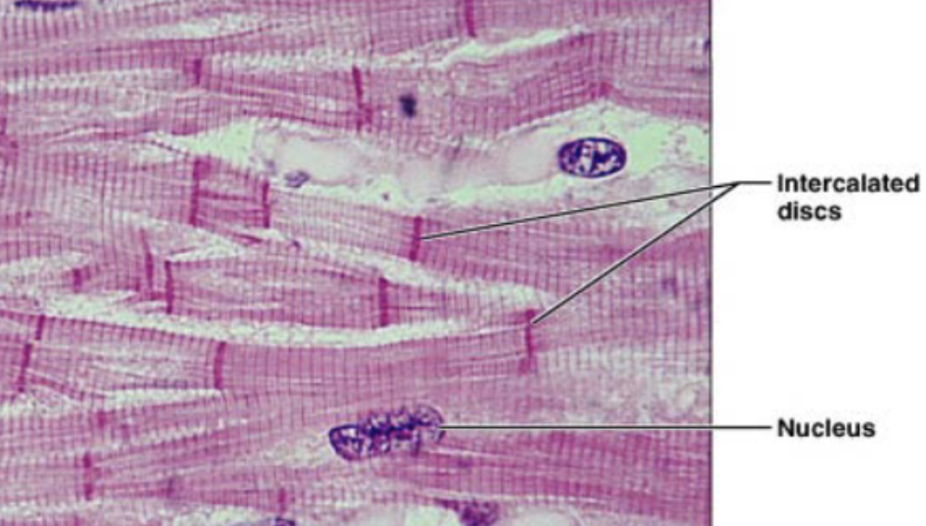 <p>striated fibers, cells are short and branched, usually 1-2 nuclei per cell, intercalated disc, gap junction to allow contraction as unit</p>
