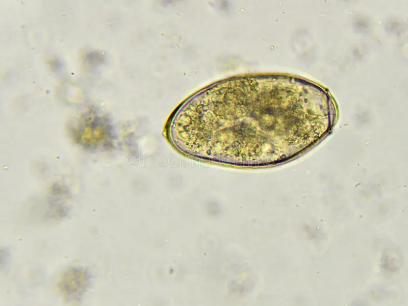 <p><em><span>Paragonimus westermani</span></em><span> egg</span></p>