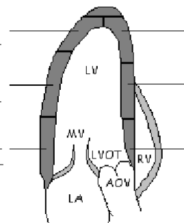 <p>What is bottom left wall of the image?</p>